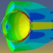 Computational modeling of newborn retinal hemorrhaging