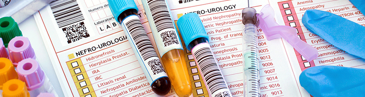 Blood Test Vials